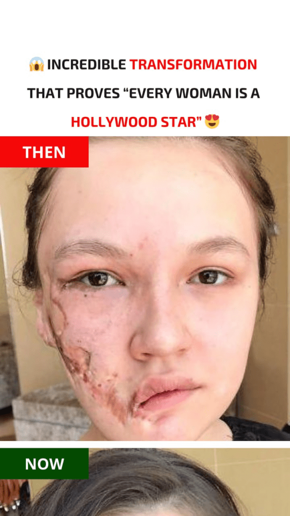 media 1