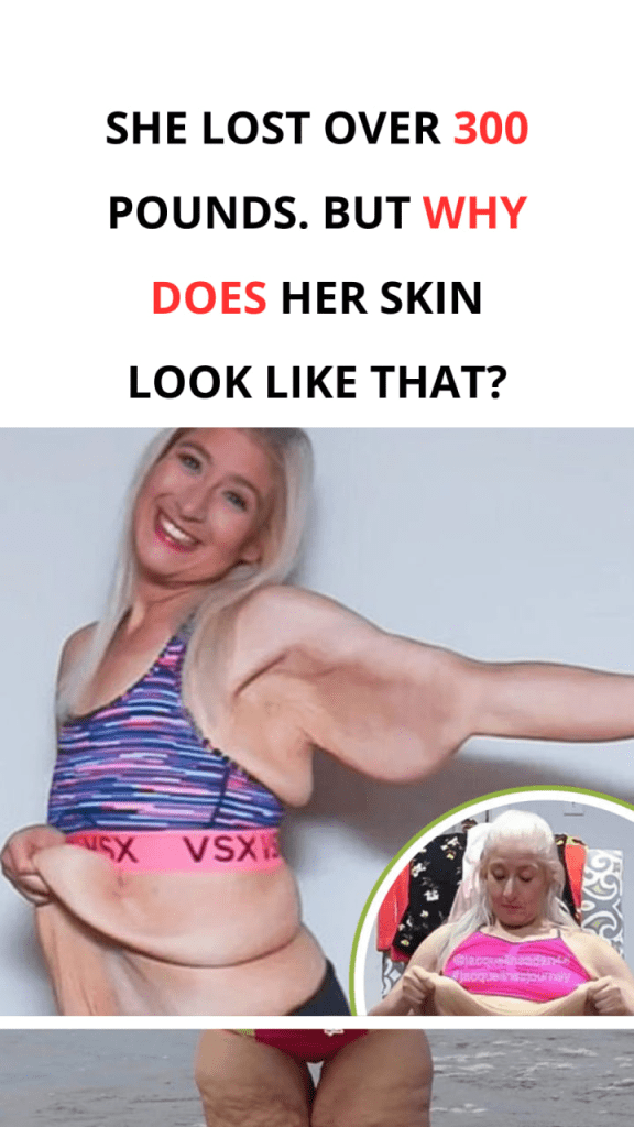 media 1